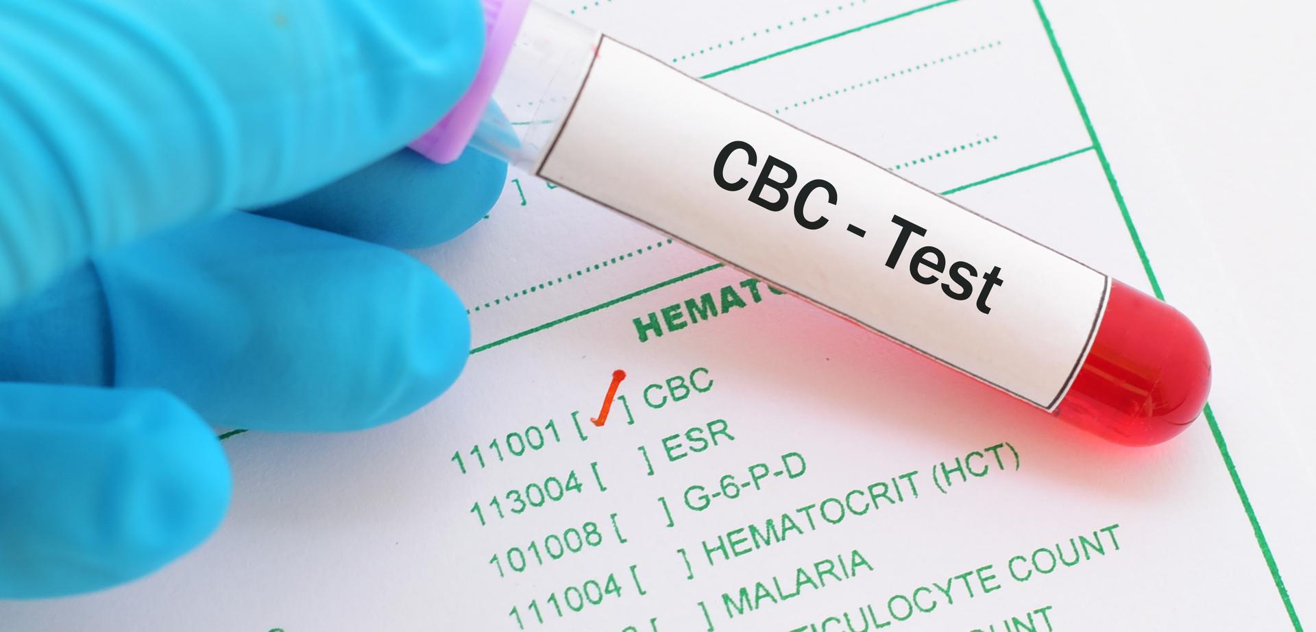 what is CBC test ?