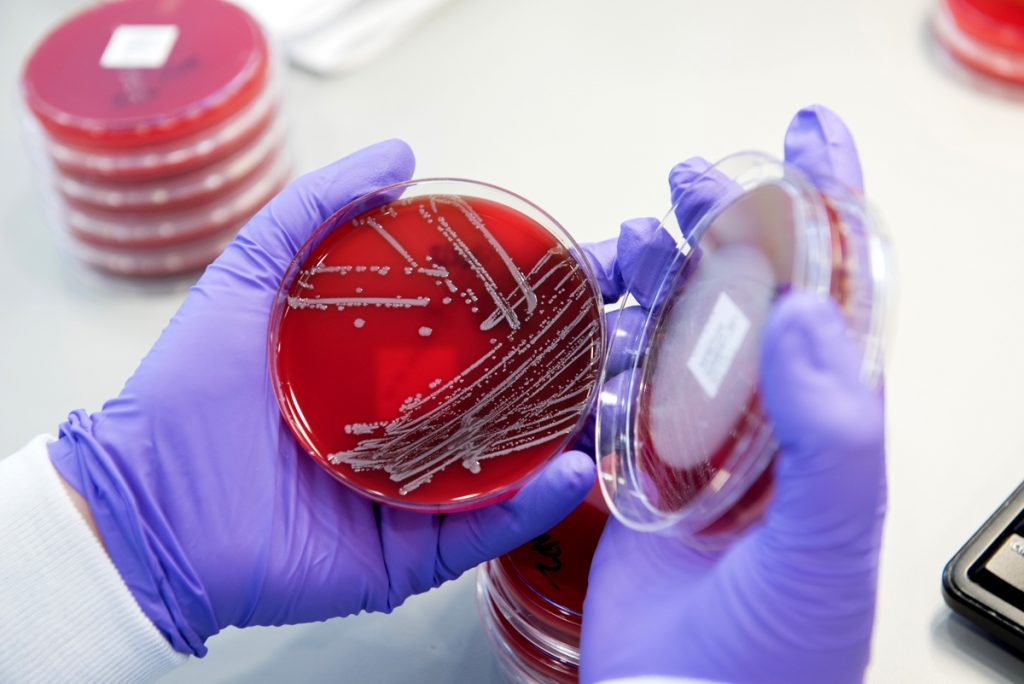 Microbiology Services