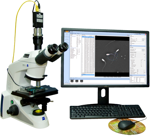 SCA Semen Analysis